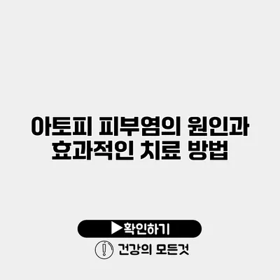 아토피 피부염의 원인과 효과적인 치료 방법
